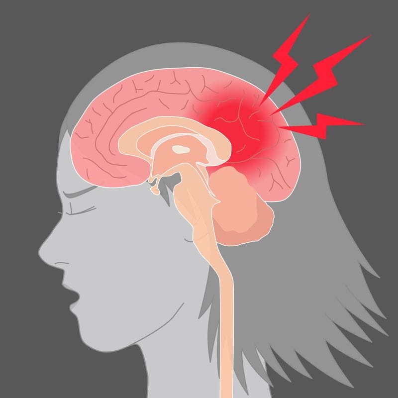 Post-Concussion Syndrome: Management for Adults